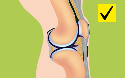 Knie-Illustration